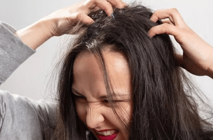11 Cara Menghilangkan Ketombe yang Membandel dengan Mudah